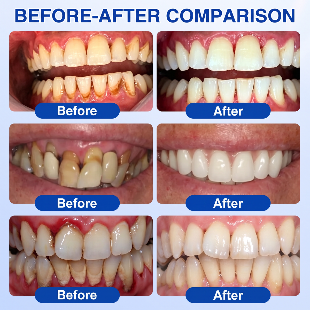 GumRevive periodontal repair gel