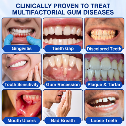 GumRevive periodontal repair gel