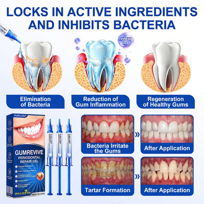 GumRevive periodontal repair gel